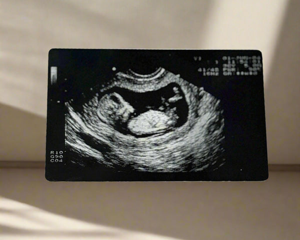 Ultrasound image of a fetus on a black card with a white background