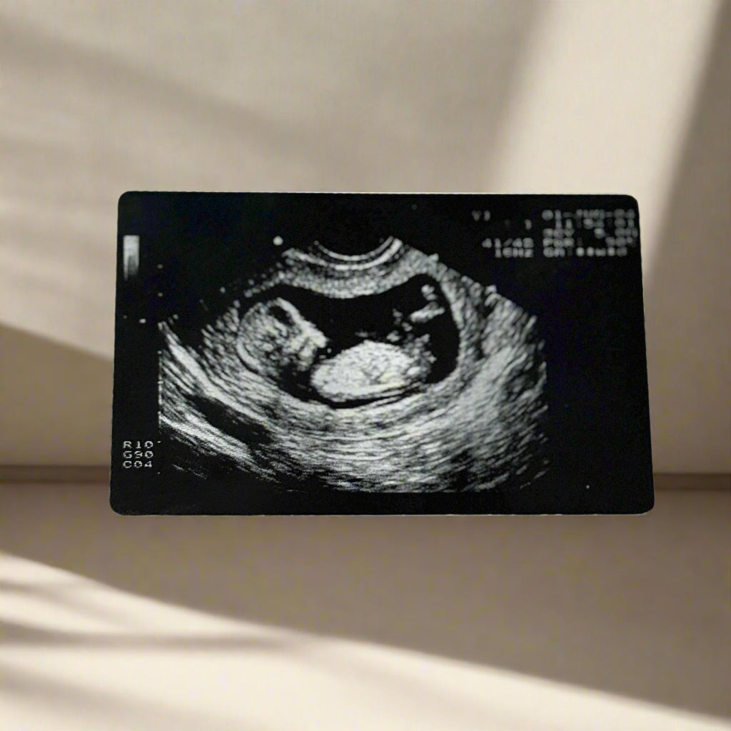 Ultrasound image of a fetus on a black card with a white background